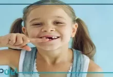 برای استحکام دندان کودکان چه کنیم؟【سال1402】