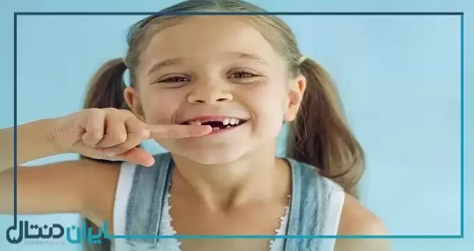 برای استحکام دندان کودکان چه کنیم؟【سال1402】